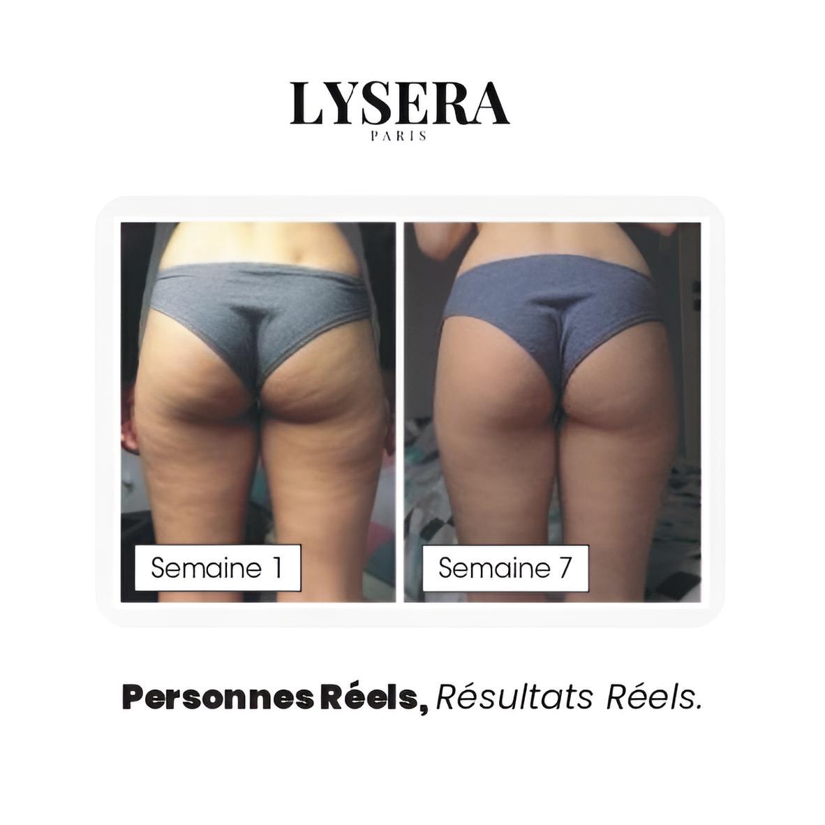 Legging 3D Anti-Cellulite