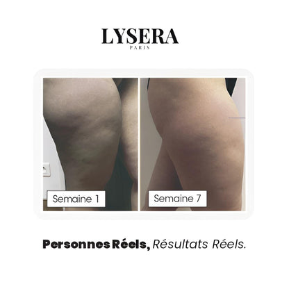 Legging 3D Anti-Cellulite