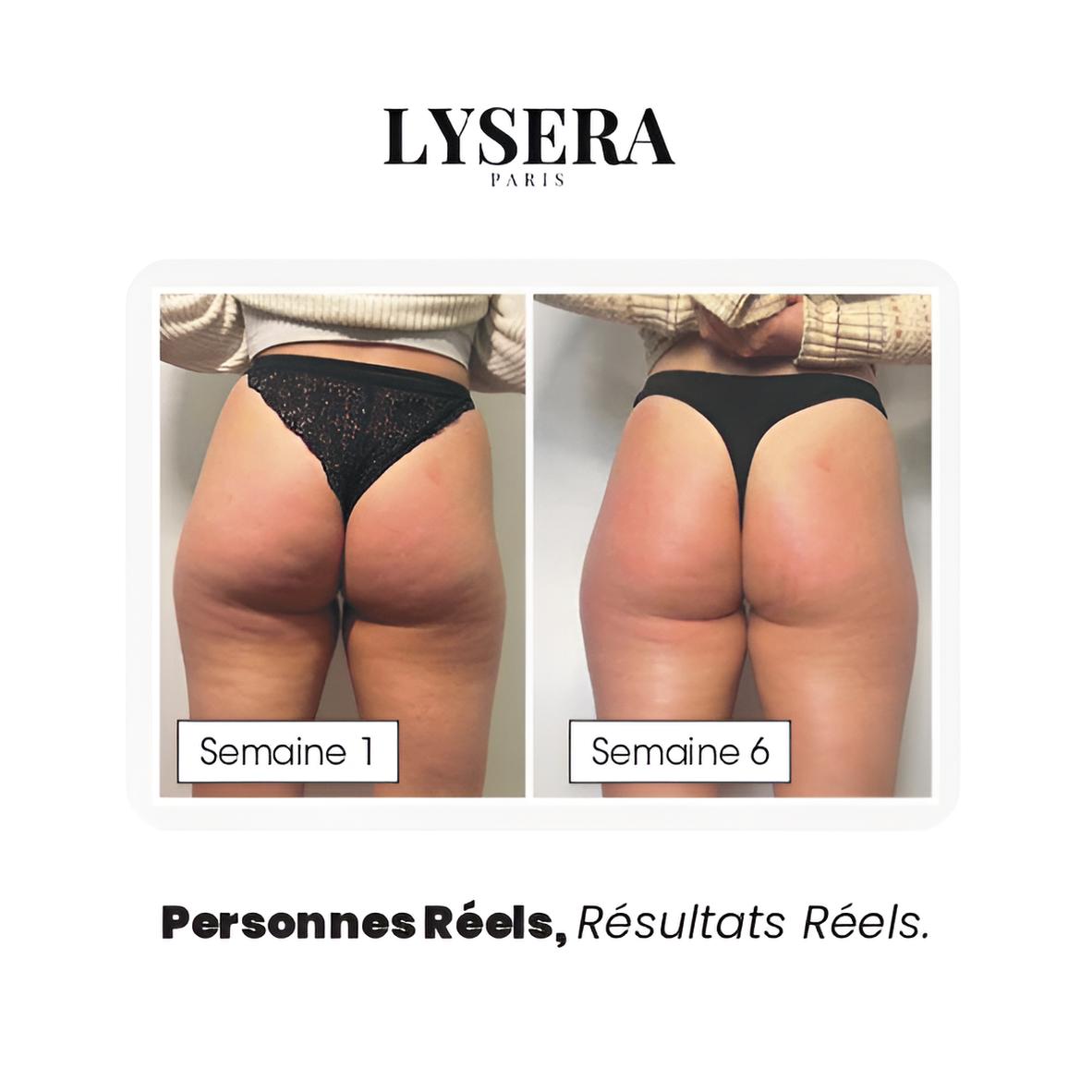 Legging 3D Anti-Cellulite